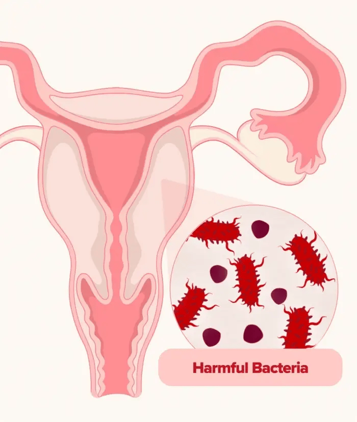 🔥 Bye-bye les déséquilibres et les odeurs vaginales ! boîte URO pour femmes